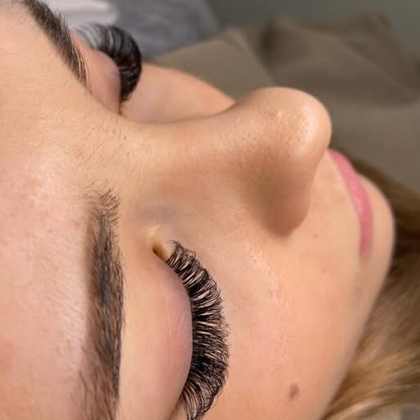 Skropstu pieaudzēšana Cēsīs