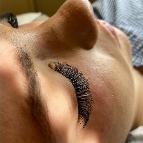 Skropstu pieaudzēšana Cēsīs