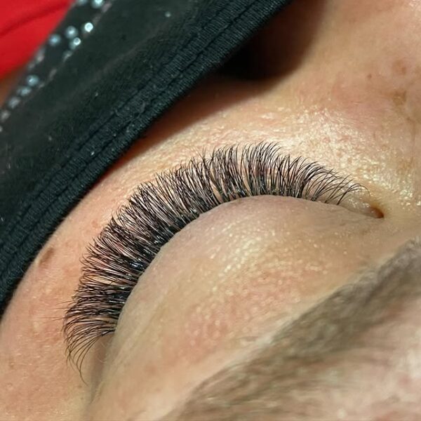 Skropstu pieaudzēšana Cēsīs