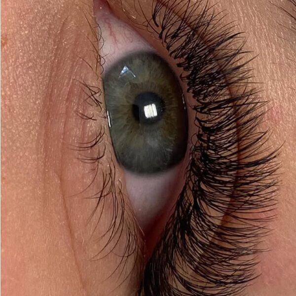 Skropstu pieaudzēšana Cēsīs